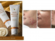 Aloe Propolis Creme Aloe Propolis Creme